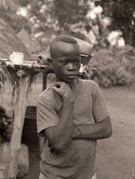 Victor Pamba, age 14, abducted by Lord Joseph Kony's LRA February 2, 2009.